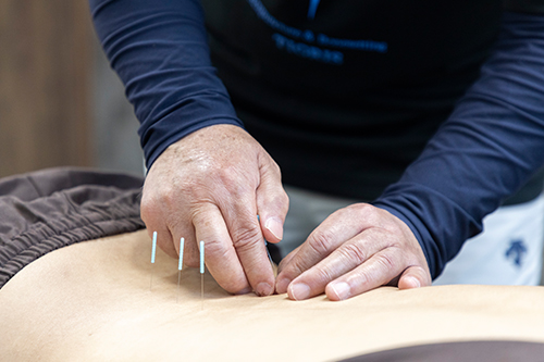 鍼治療